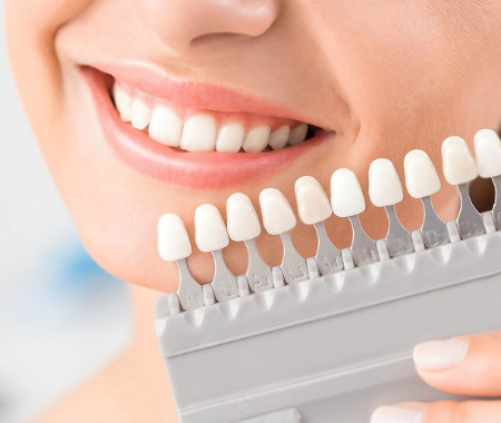 Dental implant